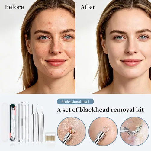 Vista 6 de DUcare Kit de herramientas para reventar espinillas, herramientas para quitar puntos negros, pinzas para el cabello encarnado, extractor de Plateado