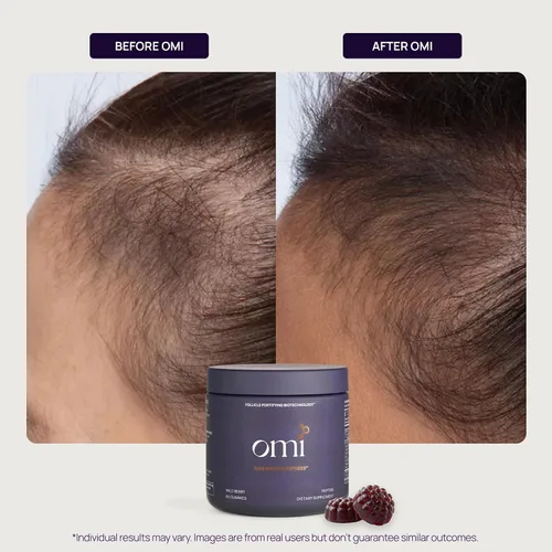 Vista 6 de OMI - Peptides for Hair Growth, Gummies for Women with Patented Follicle Fortifying Biotechnology, Now in Delicious Wild Berry Flavor