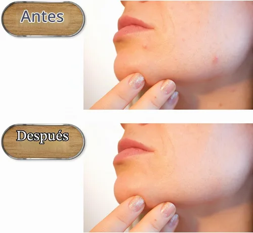 Vista 5 de Herramienta de preparación de poros, raspador facial de acero inoxidable