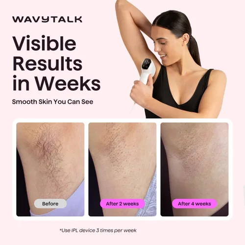Vista 10 de Wavytalk IPL - Depilación para bikini facial y corporal, resultado duradero Painless,Full Body in 12 Mins with 24J Dual-Pulse & Ice Cooling