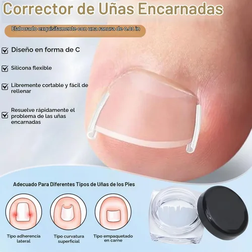 Vista 3 de Juego de corrector de uñas encarnadas con tiras correctoras, kit de eliminación de uñas encarnadas, parche corrector, herramientas de pedicura