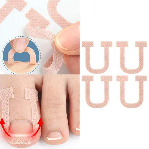 Vista 6 de Paquete de 40 parches correctores de uñas encarnadas en forma de U, correctoras de uñas de los pies, parches de corrección, vendajes para alivio