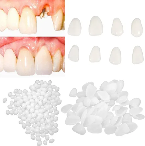 Vista 2 de womcare Kits de reparación de dientes falsos para llenar los dientes rotos y huecos que faltan - Kits de reemplazo de dientes falsos moldeables