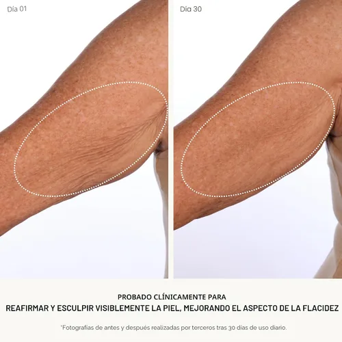 Vista 4 de U Beauty SCULPT Arm Compound Loción corporal en crema tensora para la piel, crema reafirmante para brazos y cuello con retinol + vitamina C - 4.1