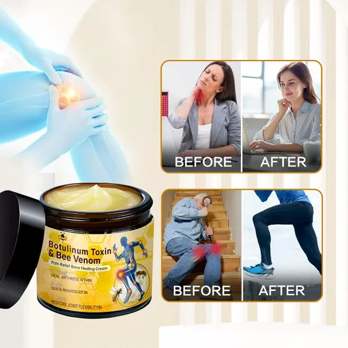 Vista 7 de 2 unidades de crema de gel para articulaciones de veneno de abeja, crema avanzada para articulaciones y huesos, gel profesional avanzado de veneno