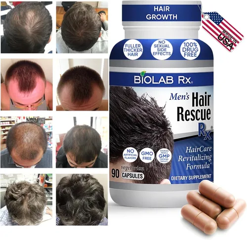 Vista 2 de Hair Rescue Rx - Suplemento para adelgazar el cabello para hombre con biotina y ortiga, soporta un cabello más grueso y saludable, soporte