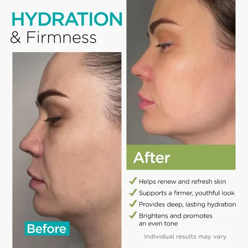 Vista 2 de Crema de Colágeno NAD+ para Rostro con Retinol Ácido Hialurónico Niacinamida para Todo Tipo de Piel - Hidratante Facial Anti-Envejecimiento