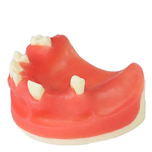 Vista 2 de Modelo de implante maxilar rojo dental con modelo de educación modelo de práctica de silicona suave