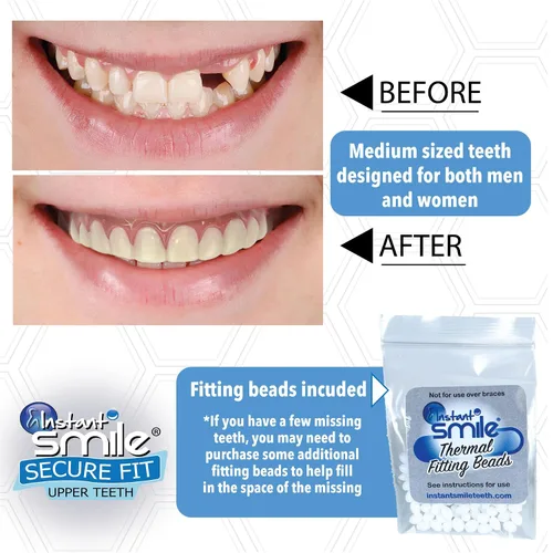 Vista 4 de Instant Smile Chapa de dientes superiores de ajuste seguro