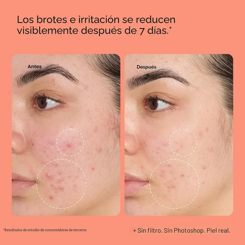 Vista 6 de Peach Slices - Spray de Recuperación Todo en Uno (118 ml) - Purifica, Calma y Alivio - Granos, Estrés y Rojeces - Spray de Ácido Hipocloroso - Agua