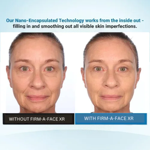 Vista 8 de Serious Skincare - Instant FIRM A FACE XR - Tensor facial temporal - Firme invisiblemente, levanta y suaviza el aspecto de líneas finas, arrugas