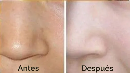 Vista 5 de AICHUN BEAUTY Lujosa mascarilla facial bio-colágeno de oro de 24 quilates (5 piezas)