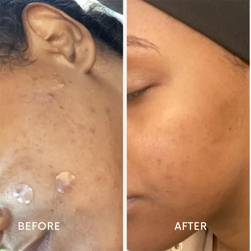Vista 7 de Nizma Skincare Crema exfoliante facial para piel seca, exfoliante facial y corporal, suaviza e hidrata, exfoliante suave pero eficaz, paquete de 10