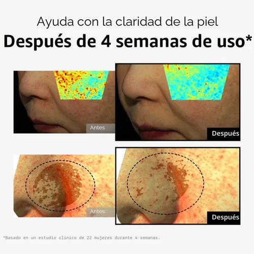 Vista 5 de DOMINAS Crema correctora de manchas oscuras Fórmula avanzada con niacinamida, TXA, hexilresorcinol y bakuchiol para reducir visiblemente