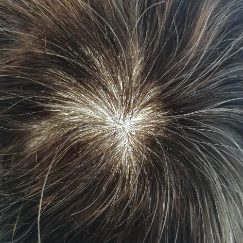 Vista 328 de Toupee para hombre 100% cabello humano real tupé para hombres 0.004 in piel de poliuretano para hombre, sistema de reemplazo de piezas de pelo