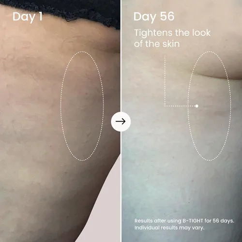 Vista 4 de MAËLYS B-TIGHT Lift & Firm Booty Mask - Crema reafirmante y reafirmante para glúteos y muslos, crema para la celulitis con cafeína y pimienta