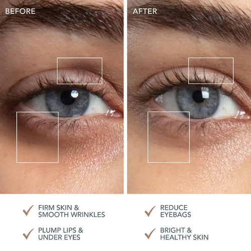 Vista 6 de FOREO SUPERCHARGED - Suero potenciador de contorno de ojos y labios, gel conductor, suero de niacinamida, suero antienvejecimiento, tratamiento