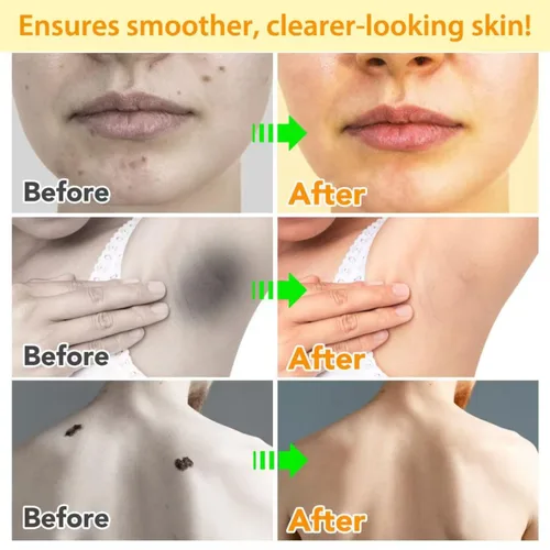Vista 9 de Bee Venom Cream, nueva crema reparadora de tratamiento de la piel para todas las partes del cuerpo, gel de miel suave profesional para todo