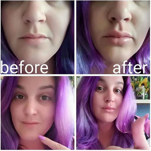 Vista 4 de Dispositivo de relleno de labios Refuerzo de labios de silicona suave con forma de pez, boca más gruesa más completa, bombas de labios