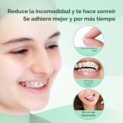 Vista 4 de JMU - Cera de ortodoncia para aparatos ortopédicos, 1 paquete, 50 puntos de cera dental precortados, menta