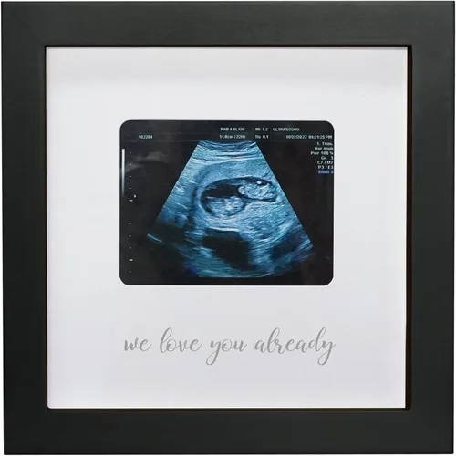 Vista 7 de Sonogram - Marco de fotos para abuela, marco de fotos de ultrasonido, anuncio de embarazo para abuela, ideas de anuncio de bebé, marco de fotos
