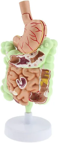 Vista 6 de KESOTO Modelo de Patología Gastrointestinal Humana Modelo Coronal Gástrico del Tracto Digestivo para Estudiantes Escolares Aprendizaje