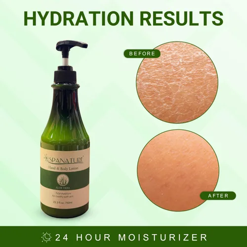 Vista 4 de Spanature Loción corporal de aloe vera premium para mujeres, alivio de quemaduras solares, loción calmante de aloe e hidratante corporal para piel