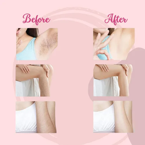Vista 4 de Borrador de pelo de cristal, depiladora para mujeres y hombres, herramienta reutilizable para depilación y exfoliación, borrador de vello facial