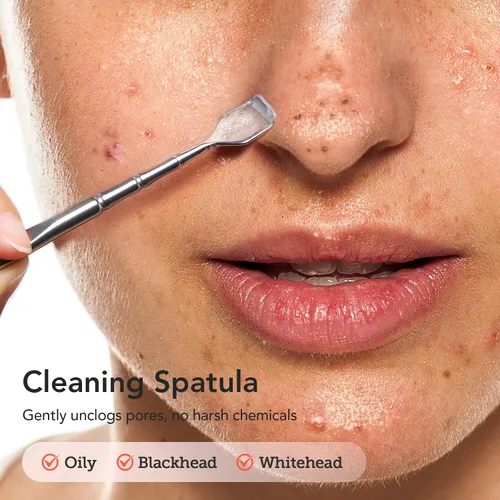 Vista 2 de Litbear - Juego de herramientas para eliminar puntos negros, 6 unidades Blackhead Pimple Comedones Extractor, Acne Tools Extractor kit, Scraper