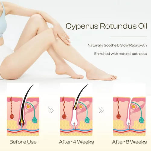 Vista 4 de Aceite Cyperus Rotundus para depilación: reduce el crecimiento no deseado del cabello, ralentiza el nuevo crecimiento, calma la piel y encoge