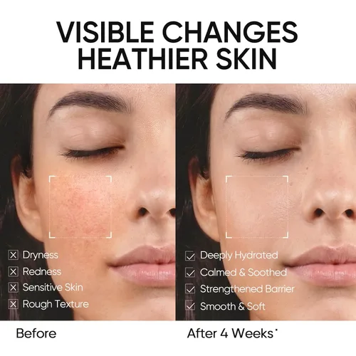 Vista 3 de SKINTIFIC Hidratante facial con 5 ceramidas, crema reparadora de barrera hidratante para pieles sensibles/aceitosas, ácido hialurónico y centella