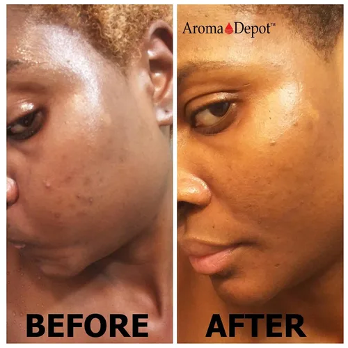 Vista 5 de Aroma Depot Jabón negro africano crudo 4oz jabón natural 100% crudo para acné, eczema, psoriasis, eliminación de cicatrices cara y lavado corporal.