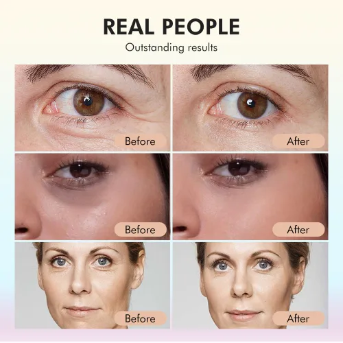 Vista 3 de Paquete de 2 sueros faciales, suero de retinol con vitamina C antienvejecimiento para cara con retinol y aminoácidos, aumenta el colágeno