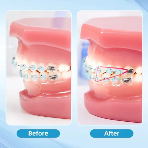 Vista 7 de Annhua Bandas elásticas de ortodoncia, 500 unidades (3.5 onzas, 1/4 pulgadas), bandas de tracción de goma dental, bandas para huecos dentales, aseo