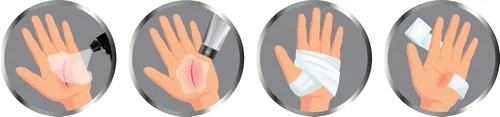 Vista 4 de Pulverizador de lavado de heridas Nano Silver Spray Debride & Fine Mist 4 onzas líquidas