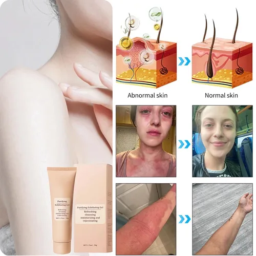 Vista 6 de Gel exfoliante purificador, limpiador facial y exfoliante de limpieza profunda para rostro y cuerpo, hidratante limpia la piel y limpia la suciedad