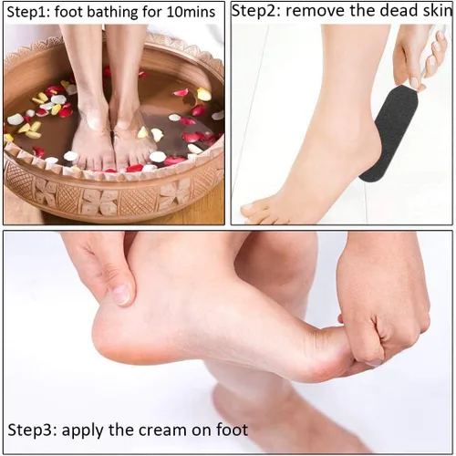 Vista 6 de Lima de pedicura profesional para pies – Reutilizable de acero inoxidable agrietado callos de la piel removedor de callos