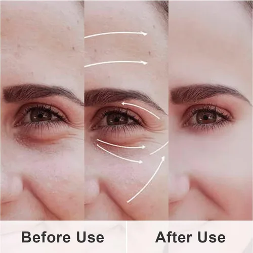 Vista 5 de Mascarilla de gel refrescante con agujeros, 2 paquetes de ojos fríos para ojos hinchados e hinchazón, paquete de gel de calor reutilizable