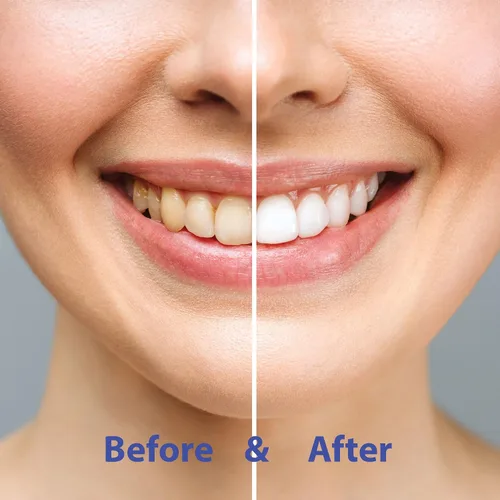Vista 5 de Chomp toothpaste Tabletas Recarga Menta