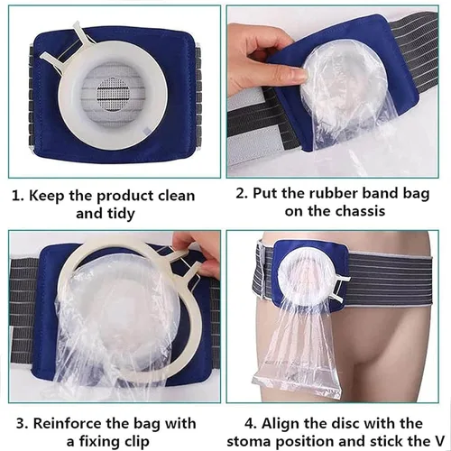 Vista 5 de Bolsa de colostomía unisex para estomía, cinturón de hernia de ostomía para cuidado postoperatorio de anorrectal, para prevenir hernia parastomal