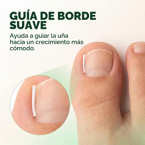 Vista 3 de Kit de tiras correctoras de uñas encarnadas, 10 piezas de tiras correctoras de uñas encarnadas, tiras alisadoras de uñas encarnadas, clips