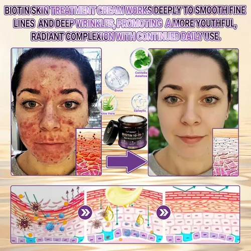 Vista 6 de Qiawi Biotin 10 en 1 Crema restauradora de piel, biotina 10 en 1 crema para hidratar la piel, suavizar la piel e hidratar (1 unidad)