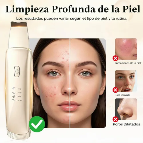 Vista 6 de Herramientas para quitar puntos negros, espátula facial 4 en 1 para Dorado