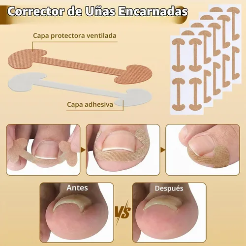 Vista 6 de Juego de corrector de uñas encarnadas con tiras correctoras y lima sin dolor, kit profesional de eliminación de uñas encarnadas con herramienta