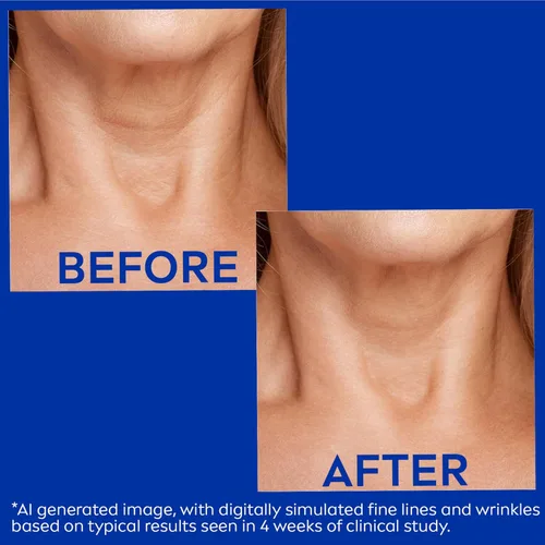 Vista 5 de NIVEA Crema reafirmante y antiarrugas para el cuello y el pecho con coenzima Q10, creatina y provitamina B5, crema reafirmante para la piel que