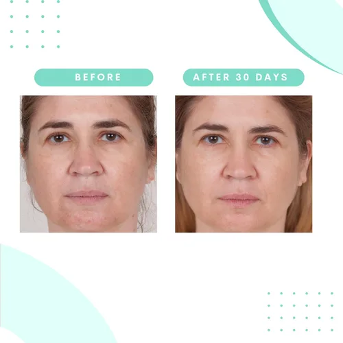 Vista 5 de Serious Skincare Limpiador facial glicólico de 12 onzas + herramienta de limpieza de cepillo facial oscilante, fórmula cremosa de limpieza profunda