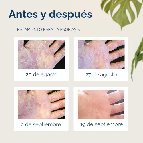 Vista 3 de Blindaje de guantes en una botella Loción – Ideal para piel seca Itchy. grease-less y fragancia gratis.