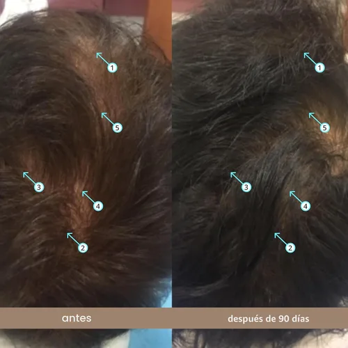 Vista 5 de DS Labs Spectral Suero para la Densidad Capilar Masculina (anteriormente Spectral.DNC-N), 60mL - Tratamiento Ligero de Uso Diario para un Cabello