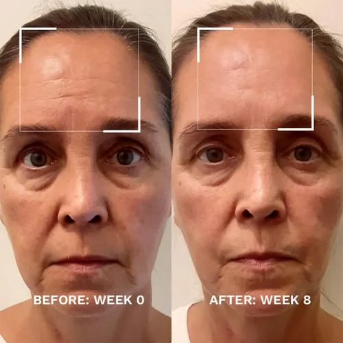 Vista 2 de City Beauty Refuerzo de piel - Suero potenciador antienvejecimiento para la cara - Levanta y aprieta - Solución flácida de la piel con péptidos
