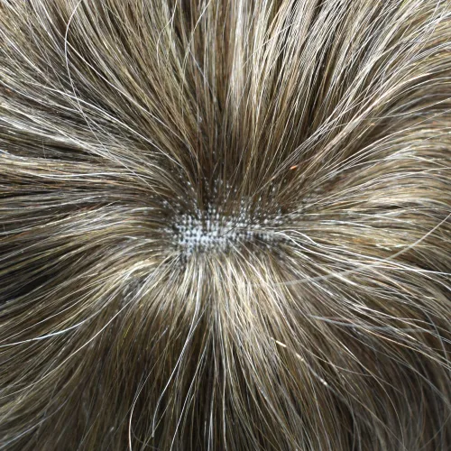 Vista 6 de Pieza de cabello para hombres suizo frente encaje frontal tupé europeo Remy sistema de reemplazo de cabello humano nudo blanqueado línea capilar